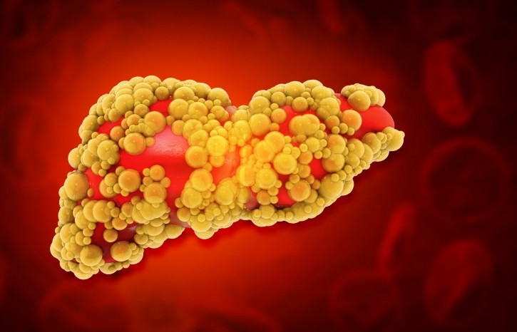 Outsourcing Pharma: Breath test can reveal signs of liver cirrhosis and portal hypertension